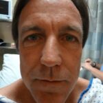 Brow Lift, Blepharoplasty, Face and Neck Lift
